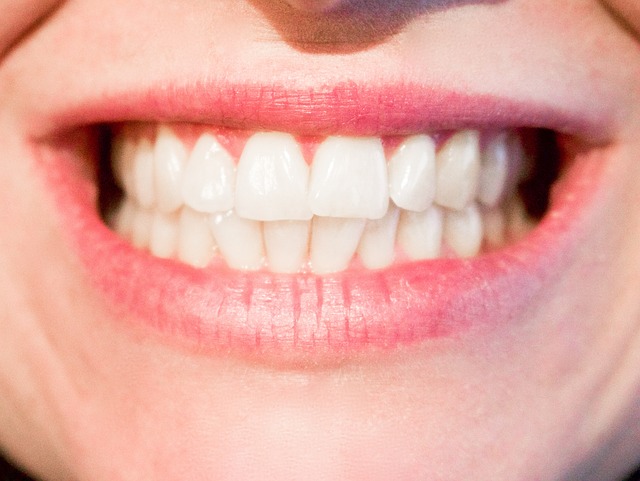 ortodonta efekty